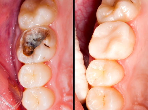 Restorative Dentistry